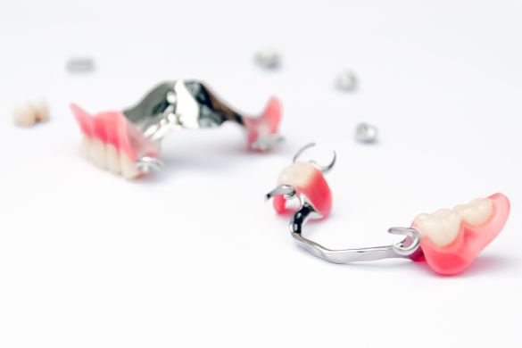 Prótesis dentales removibles